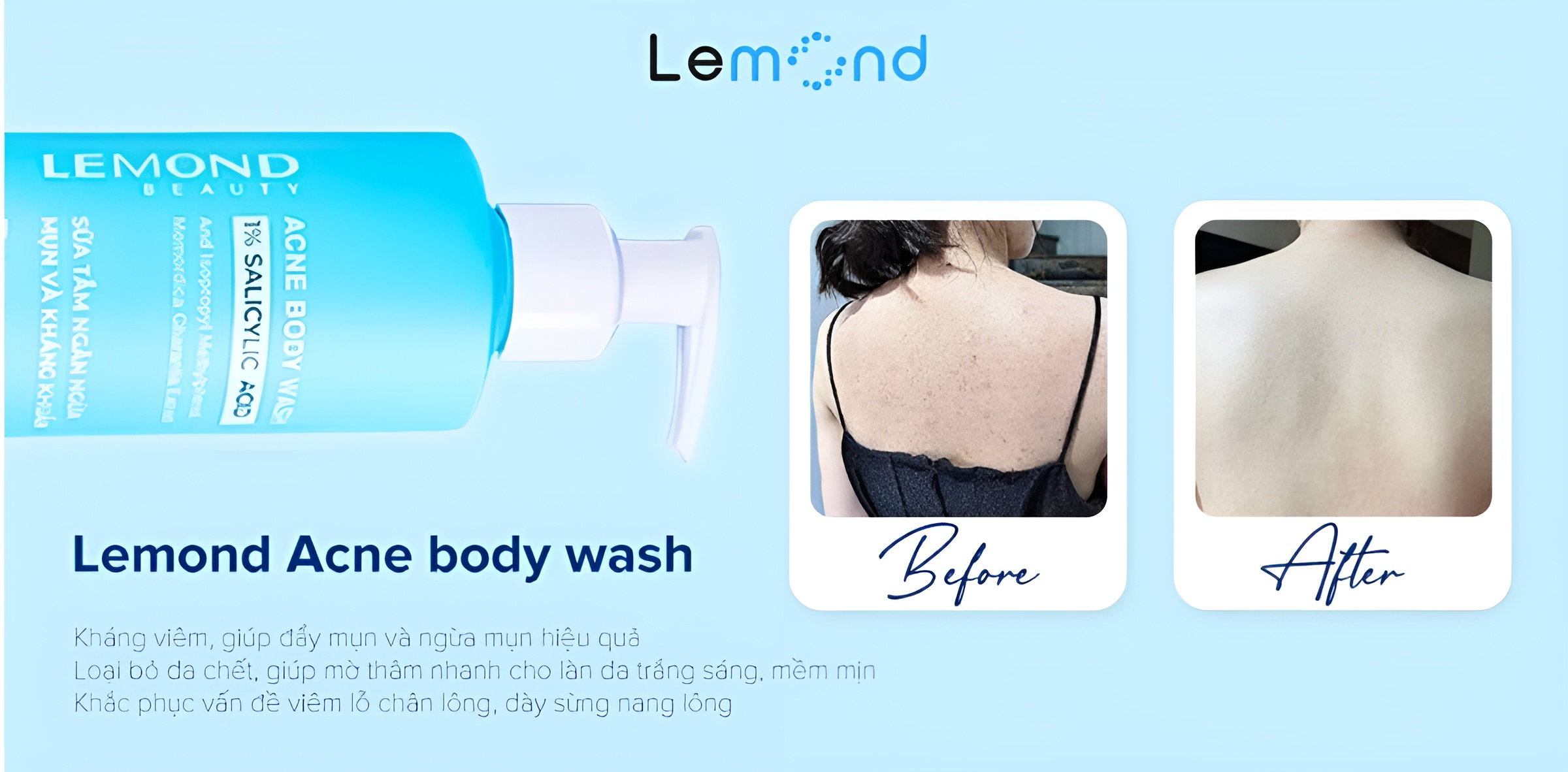 Công dụng của Lemond Acne body wash