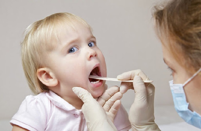 Sốt viêm họng là bệnh thường gặp ở cả trẻ em và người lớn
