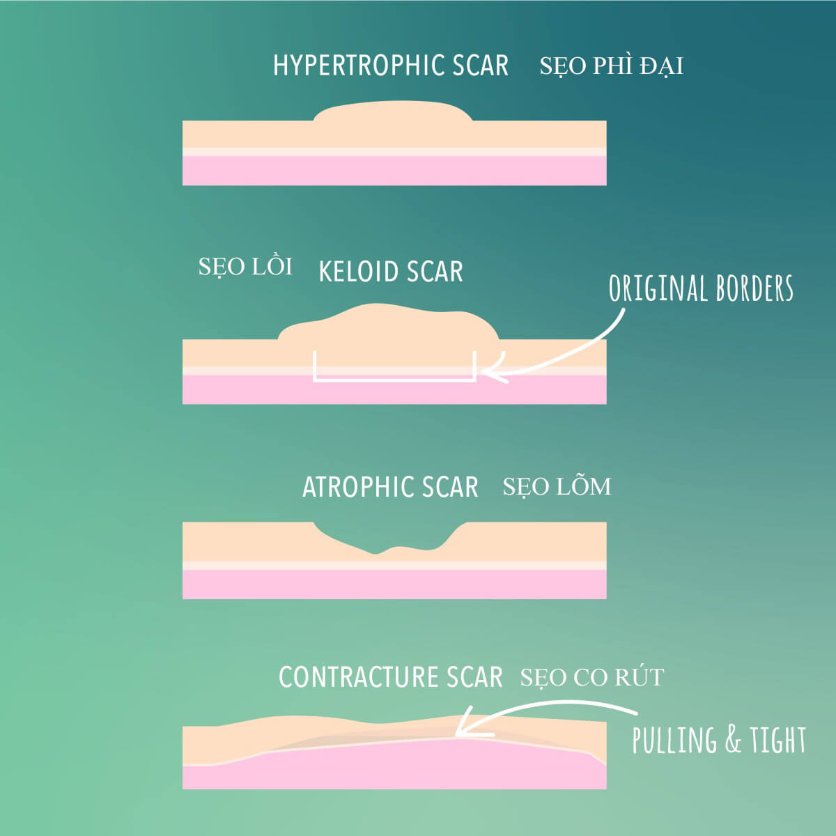Biến đổi cấu trúc da của sẹo