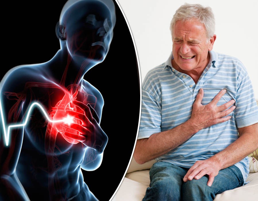 Cơn đau thắt ngực là triệu chứng điển hình của nhồi máu cơ tim