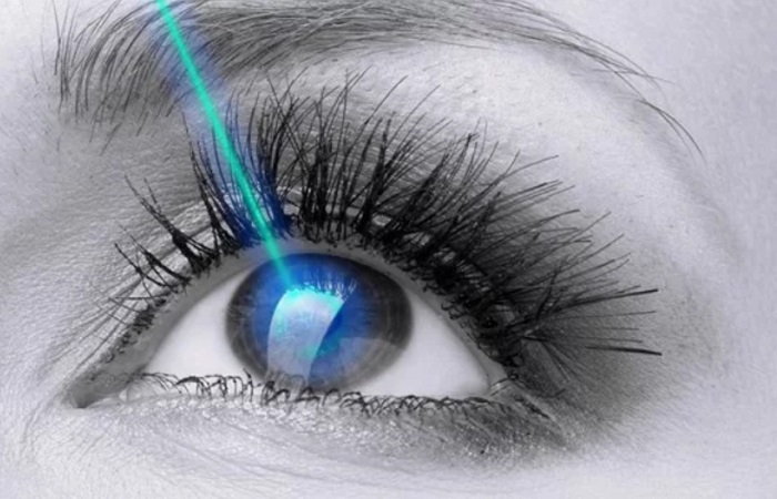 Mắt được phục hồi ngay trong ngày khi mổ mắt bằng phương pháp Lasik