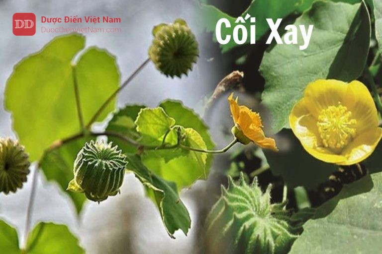 Cối xay