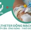 Catheter động mạch