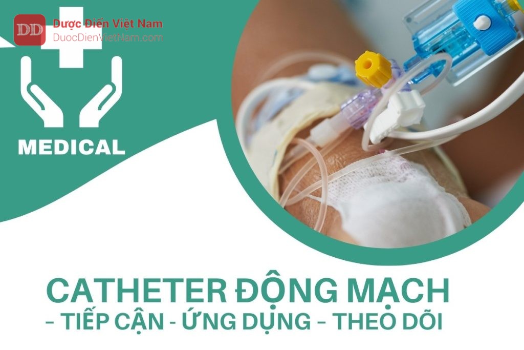 Catheter động mạch