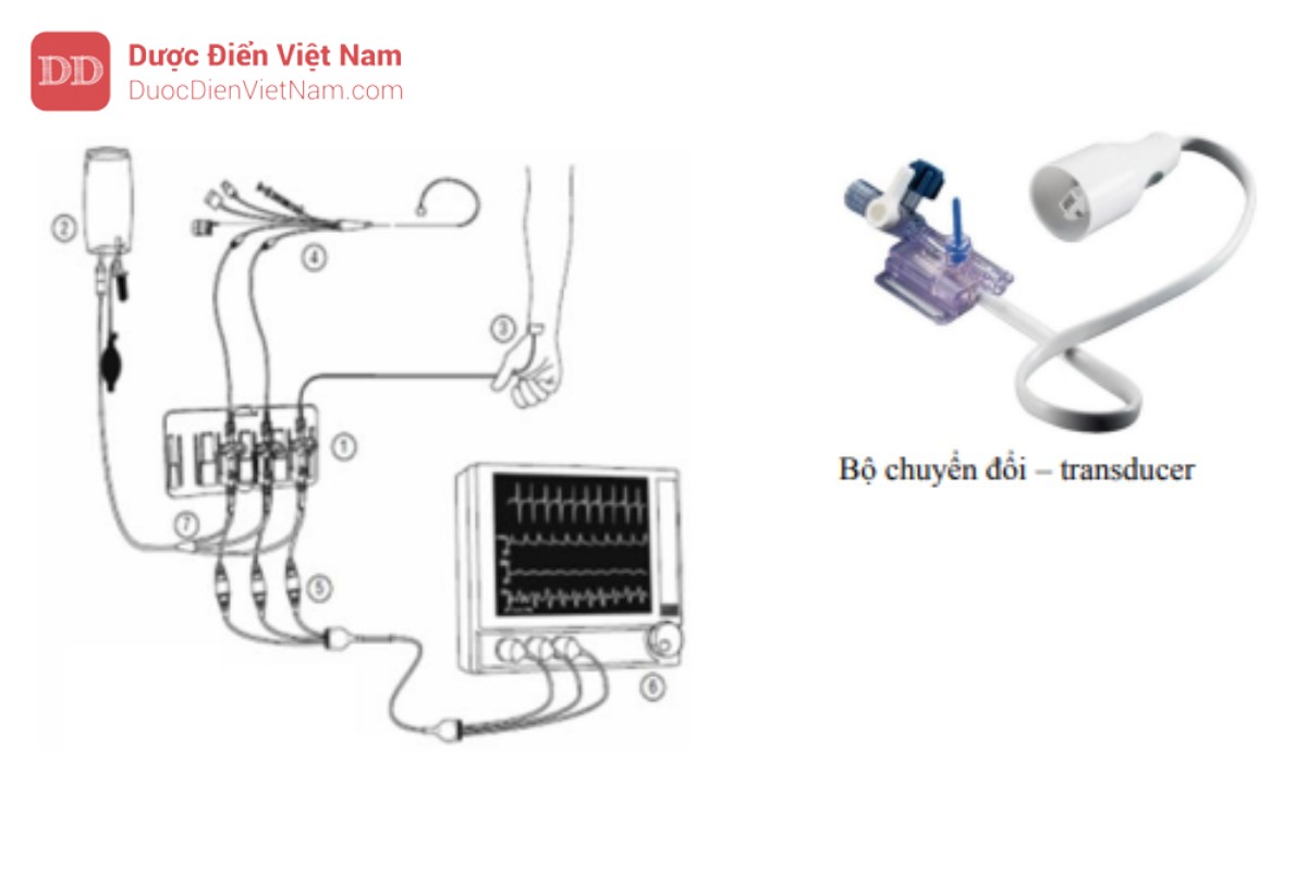 Hình 1. Nguyên lý đo huyết áp xâm lấn – 1: đầu chuyển đổi áp lực; 2: túi áp lực có nước muối sinh lý; 3: catheter trong động mạch quay – hoặc 1 vị trí động mạch khác; 4: kết nối với catheter Swan-Ganz – hoặc hệ thống theo dõi huyết động khác; 5: cáp áp lực; 6: máy theo dõi; 7: đường chia ba