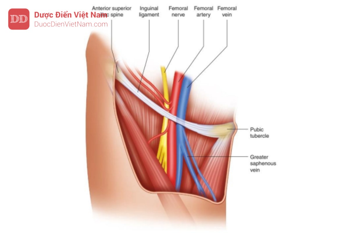 Hình 11. Vị trí giải phẫu của động mạch đùi. Động mạch đùi là lớn nhất trong số các độngmạch được sử dụng để đặt catheter. Nó cũng nằm sâu hơn các động mạch ngoại biên nên có thể cần một catheter dài hơn. Các mốc giải phẫu xương có thể được sử dụng để xác định động mạch đùi là gai chậu trước trên và củ của khớp mu. Động mạch đùi có thể được sờ thấy ở giữa hai cấu trúc này và dưới dây chằng bẹn. Để tối đa hóa khả năng tiếp cận tam giác đùi, hãy dạng nhẹ hông và duỗi chân. Chú ý đến sự gần gũi của dây thần kinh đùi và tĩnh mạch.