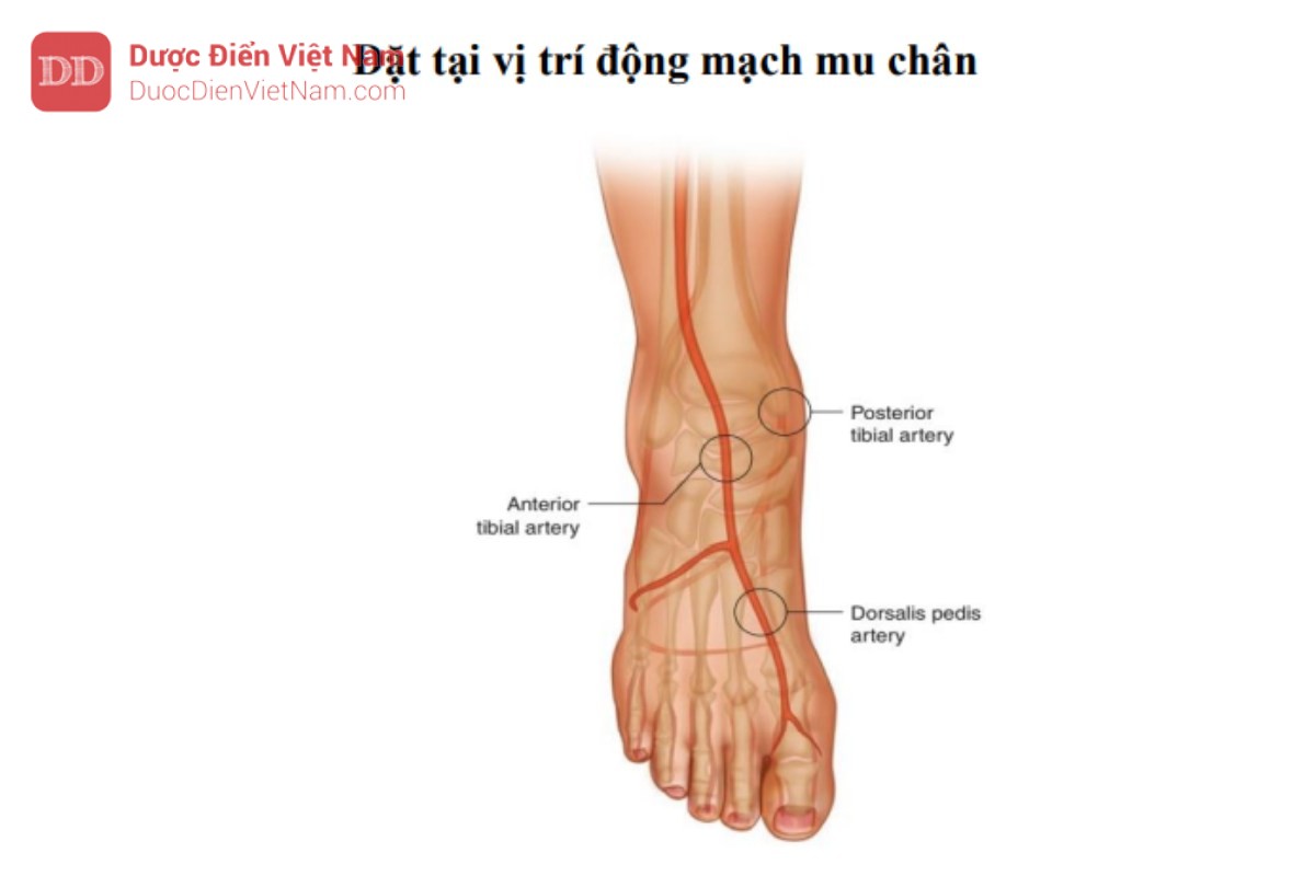 Hình 12. Vị trí giải phẫu của động mạch lưng bàn chân. Động mạch mu bàn chân là sự tiếpnối của động mạch chày trước. Có thể sờ thấy mạch giữa xương bàn chân thứ nhất và thứ hai trên mặt lưng của bàn chân