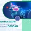 Hiểu viêm mũi xoang - Otosan