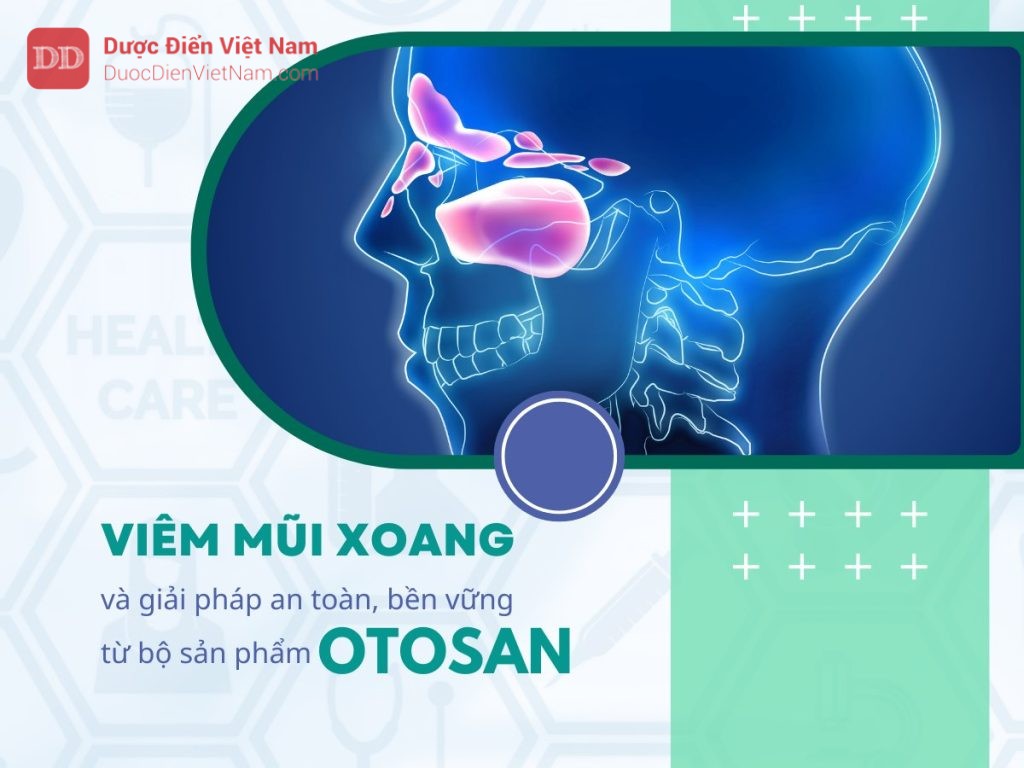 Hiểu viêm mũi xoang - Otosan