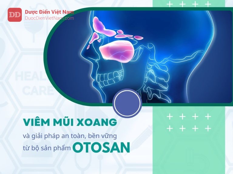 Hiểu viêm mũi xoang - Otosan