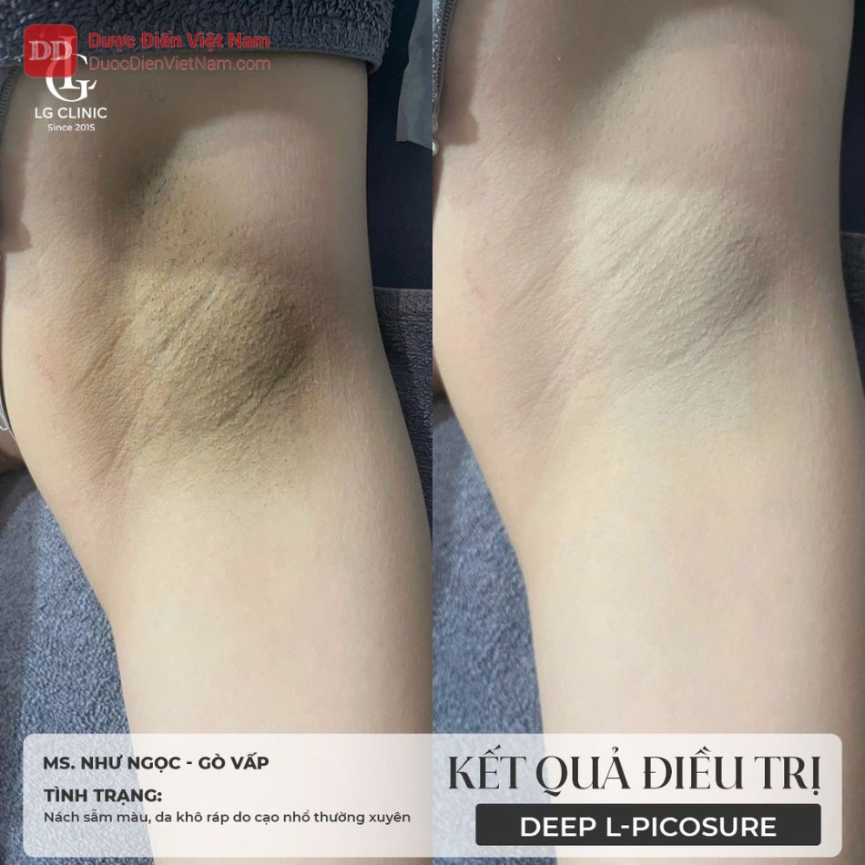 LG Clinic là hệ thống phòng khám da liễu - thẩm mỹ công nghệ cao