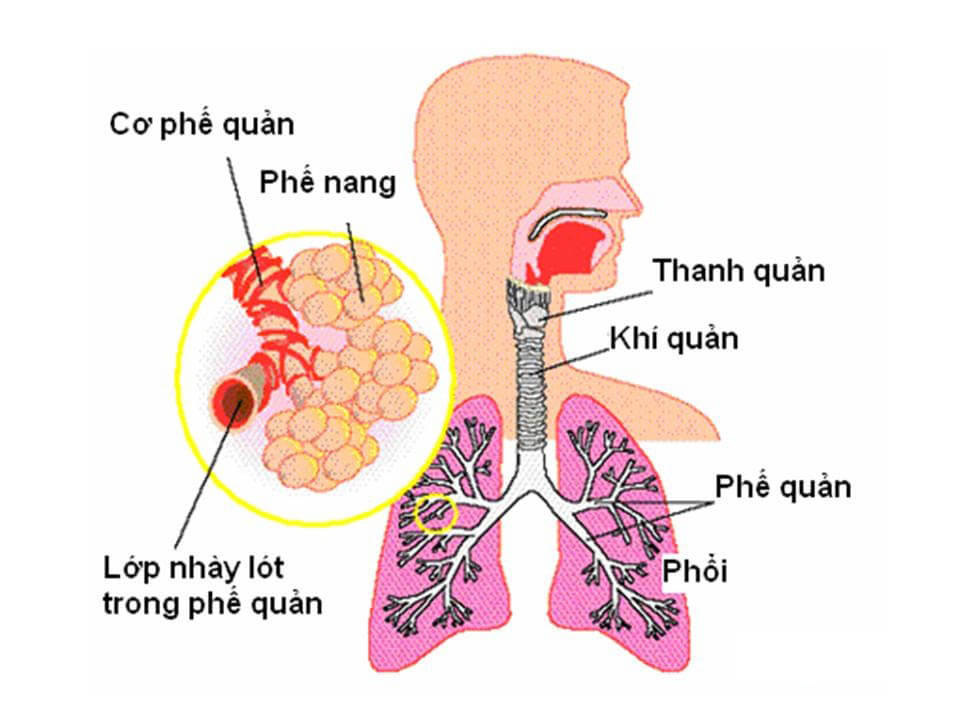 viêm phế quản phổi