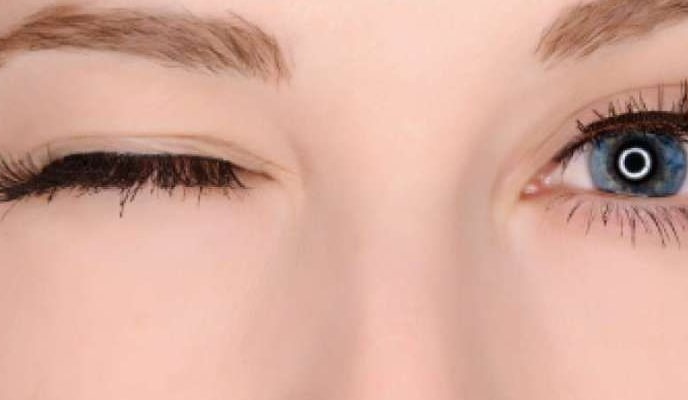 Mắt co giật là tình trạng mí mắt co thắt lặp đi lặp lại không tự chủ