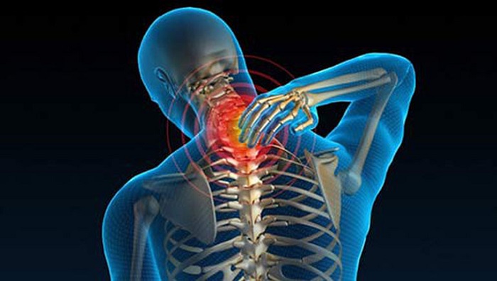 Người bị chấn thương đốt sống cổ thường có nguy cơ mắc bệnh cao hơn