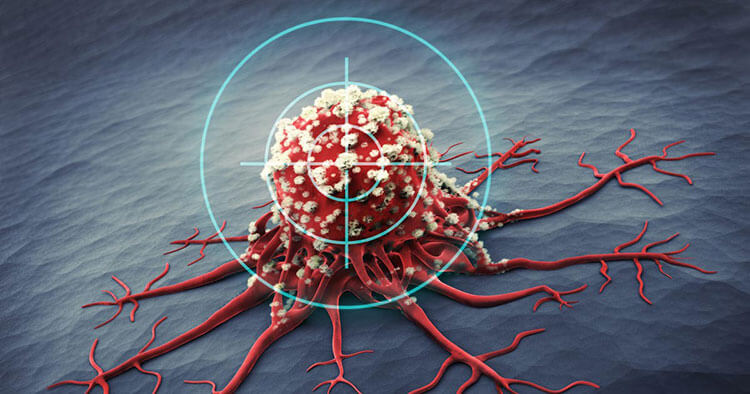 Điều trị miễn dịch giúp hệ miễn dịch phát hiện tấn công tế bào ung thư vú