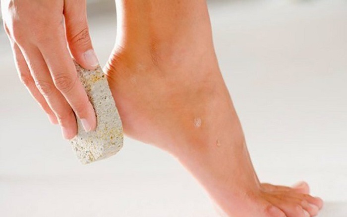 Thường xuyên tẩy tế bào chết ở gót chân để loại bỏ lớp da dày sừng