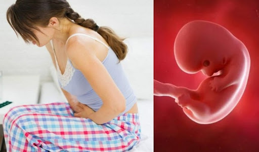 Biểu hiện khác của thai chết lưu là đau bụng, lưng