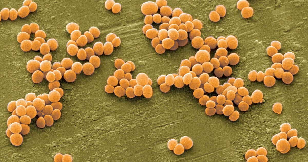 Tụ cầu (Staphylococcus aureus) gây viêm nang lông vùng kín