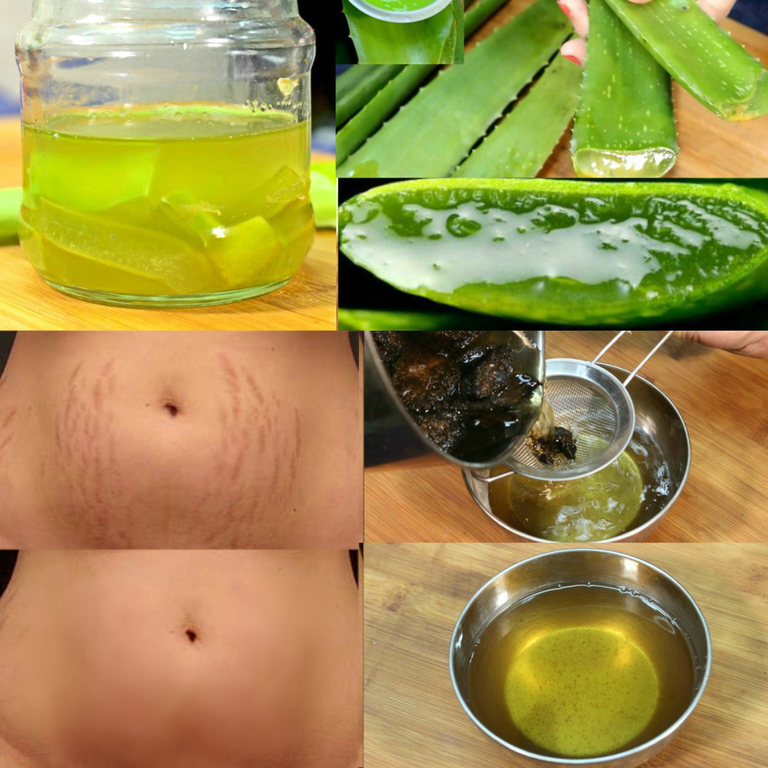 Ngăn ngừa rạn da bằng nha đam