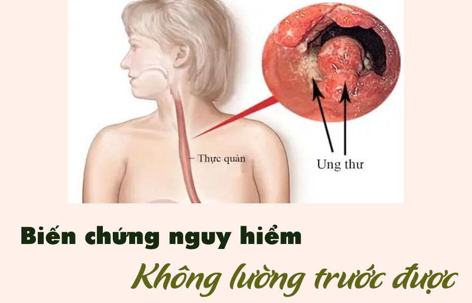 biến chứng của viêm họng