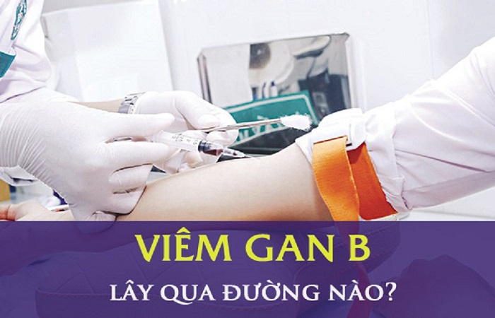 Viêm gan B dễ lây nhiễm cho người khác