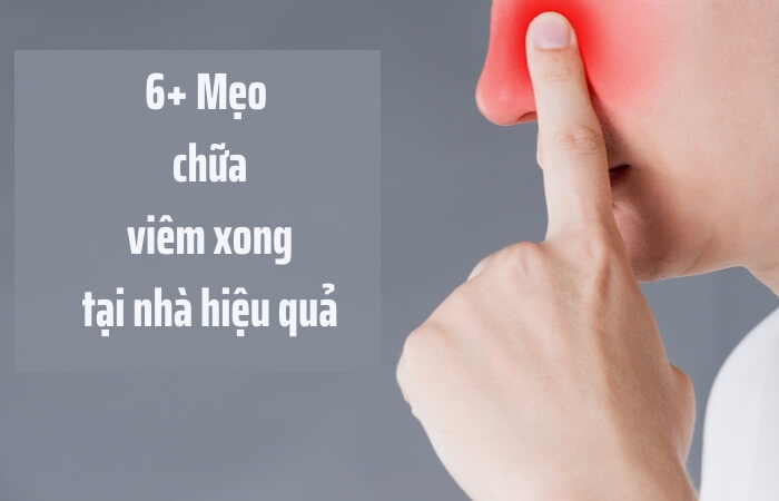 Các cách chữa viêm xoang tại nhà